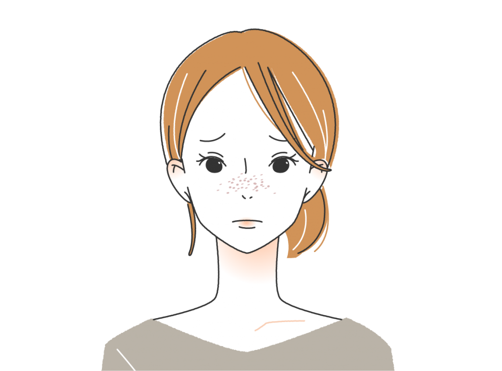 シミケア化粧品は意味が無い おすすめシミケアコスメと6つのシミケア方法 サビーナウェルネスマガジン